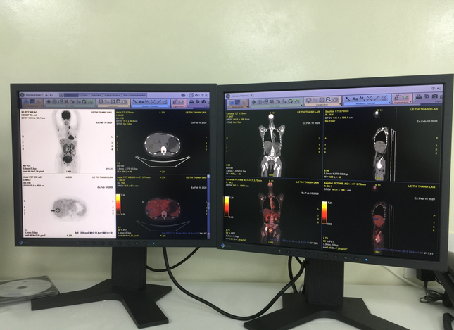 Bệnh viện Ung bướu triển khai hệ thống PET/CT trong điều trị ung thư ảnh 2