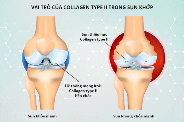 Bách Hoạt Trần Quý: Bước tiến mới trong phòng ngừa và cải thiện bệnh xương khớp ảnh 2