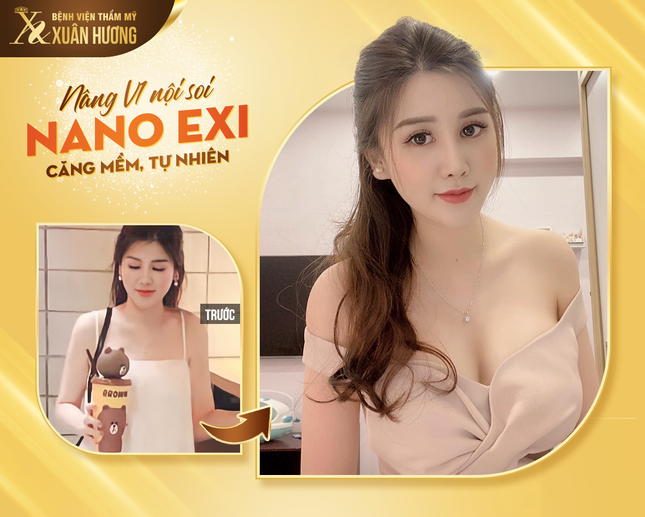 Giảm 50% nâng ngực nội soi NANO EXI tại Bệnh viện thẩm mỹ Xuân Hương ảnh 1