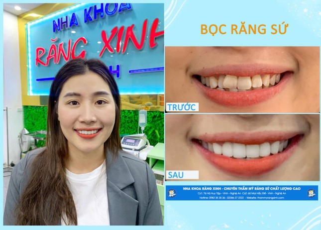 Nha khoa Răng Xinh thành phố Vinh - Sứ mệnh mang đến nụ cười toả sáng cho khách hàng ảnh 4