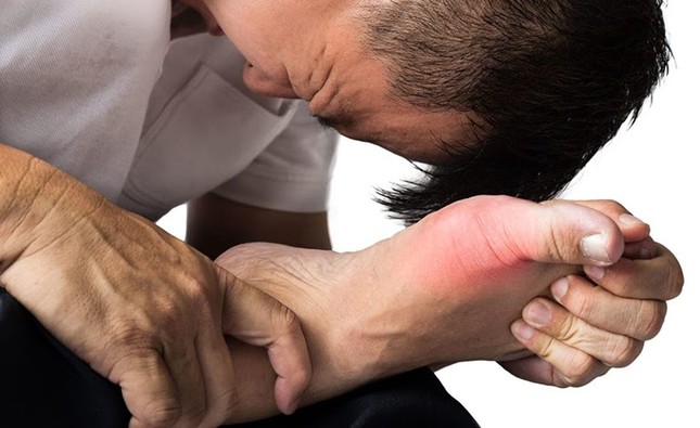 Tinh chất tiêu gout Sangu - Hướng đột phá mới trong hỗ trợ điều trị bệnh gout ảnh 1