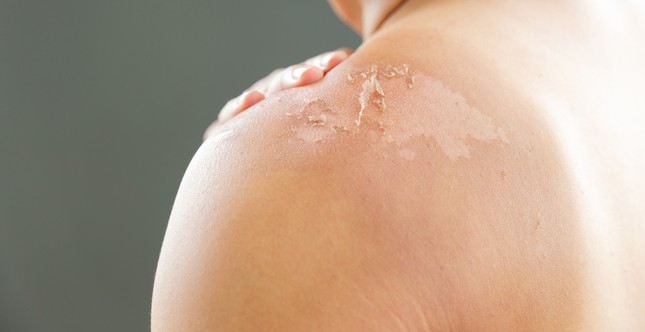 Bịt kín người mà vẫn không hiệu quả, chống nắng sao cho chuẩn? ảnh 1