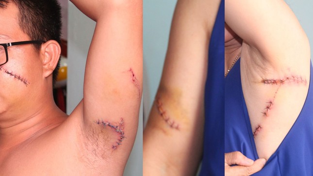 Hai mẹ con bị chém gục khi nhắc nhở hàng xóm xây lấn vỉa hè ảnh 1