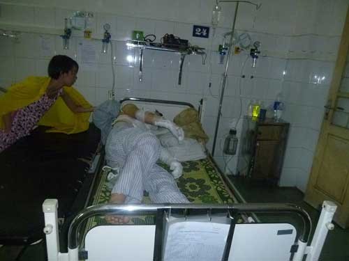 Có 5 trẻ em bị bỏng trong vụ nổ bóng