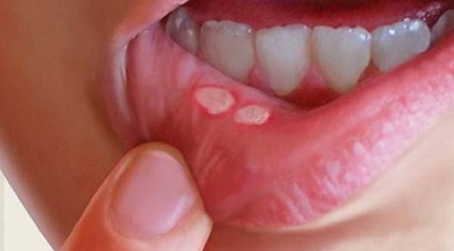 Những người này ăn dưa hấu có thể mất mạng ảnh 2