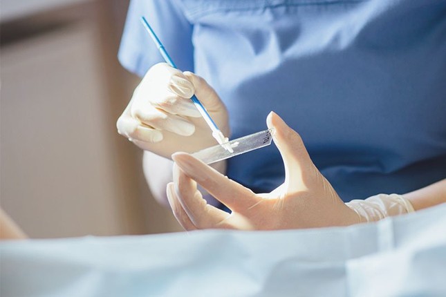 Chị em nên đi khám ung thư tử cung ngay nếu sau 25 tuổi có những dấu hiệu này ảnh 3