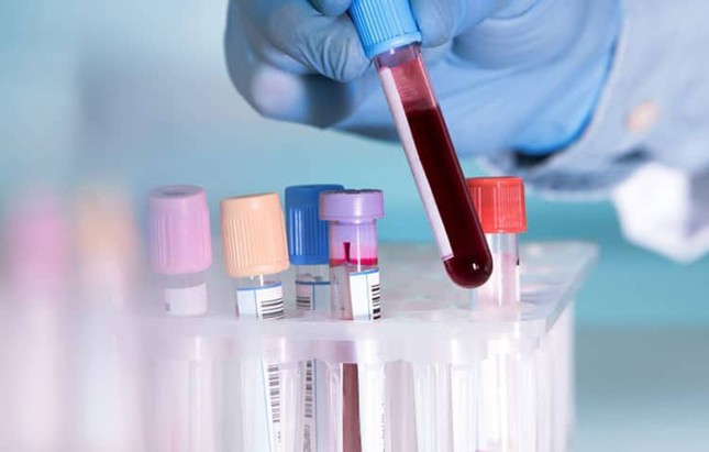 Xét nghiệm máu thông thường không thể phát hiện được HIV ảnh 1
