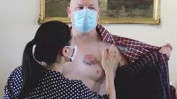 Hành khách trên xe buýt bị nhắc đeo khẩu trang liền xông tới… cắn người nhắc mình ảnh 1