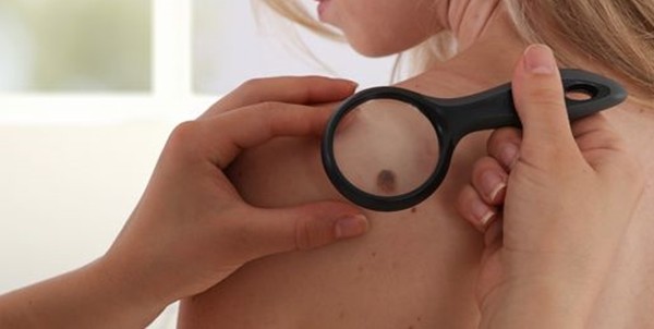 Bác sĩ cảnh báo: Trào lưu làm đẹp nguy hiểm có thể hủy hoại làn da bạn mãi mãi ảnh 2