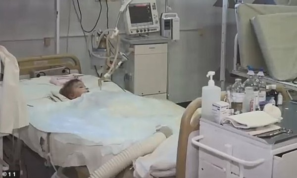 Bố mẹ mải tổ chức tiệc sinh nhật, cậu bé 2 tuổi bị chó nhà tấn công, cắn nát nhiều bộ phận ảnh 1