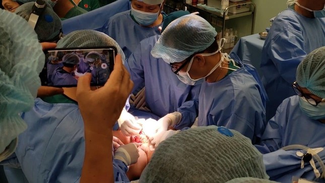 Đã tách thành công hai bé Trúc Nhi - Diệu Nhi dính nhau ảnh 4