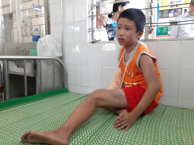 Nghi phạm đánh gãy tay bé 13 tuổi bán vé số để cướp khai gì? ảnh 1