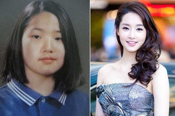 Sự thật gây sốc về bức ảnh của “Nữ hoàng dao kéo” Park Min Young trước khi thẩm mỹ ảnh 5