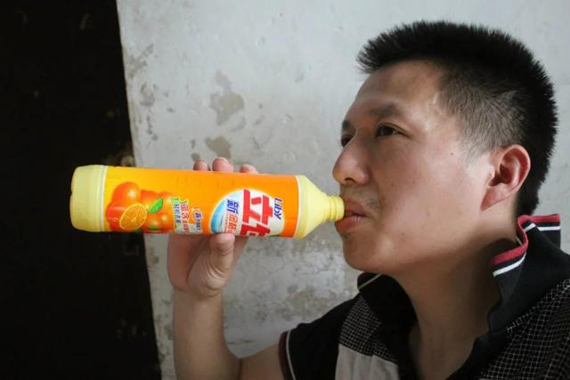 Mắc bệnh lạ, chàng trai 'nghiện' nước tẩy rửa ảnh 1