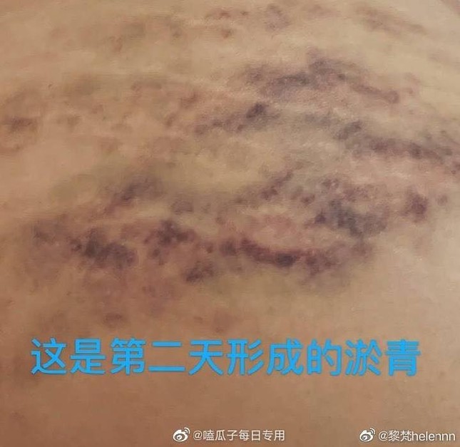 Sau La Chí Tường, lại thêm một sao nam Hoa ngữ bị bạn gái tố “biến thái” ảnh 3