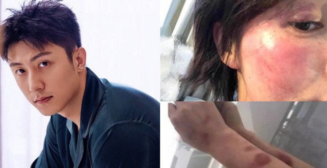 Phim mới vừa có lịch chiếu, Hoàng Cảnh Du lại bị “gọi hồn” quá khứ bạo hành ảnh 2