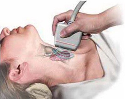 Đối phó với bệnh bướu cổ ảnh 1