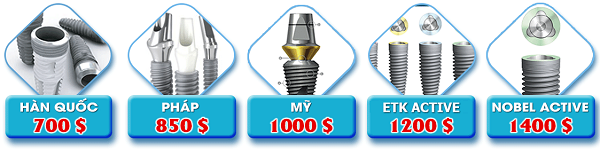 Trồng răng cấm giá bao nhiêu là chuẩn nhất? ảnh 3
