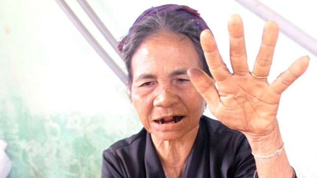 Trỗi dậy hủ tục bùa ngải ảnh 2
