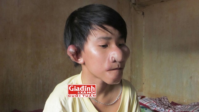 Cuộc sống cơ cực của cậu bé “Trư Bát Giới” bị cha bỏ rơi ảnh 3