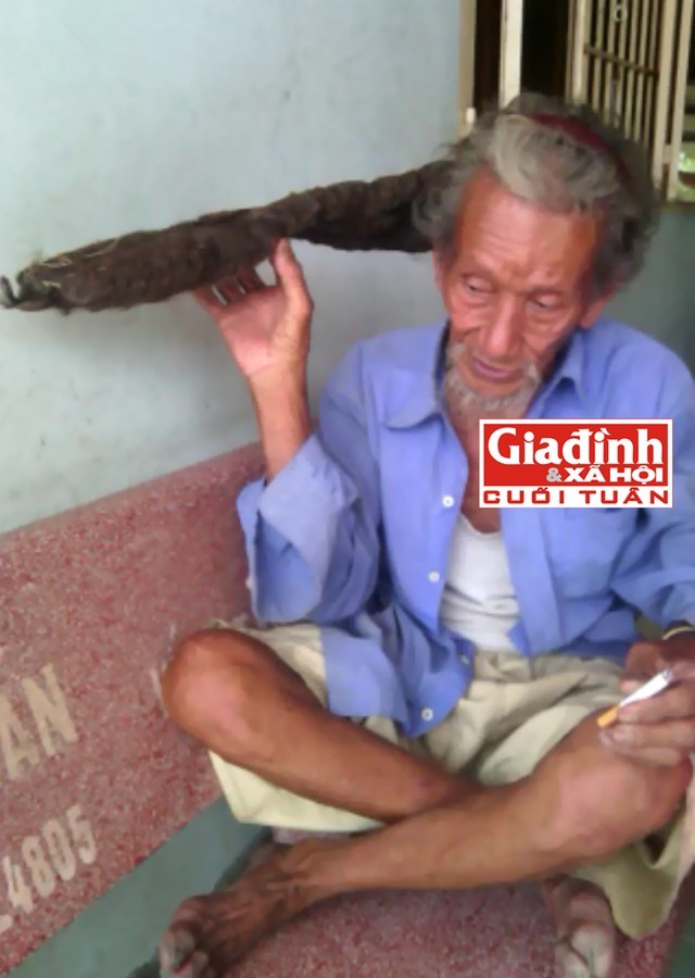 Chuyện đời kỳ lạ của ông lão 'tóc kết rồng' sau 9 ngày đêm bất tỉnh ảnh 1