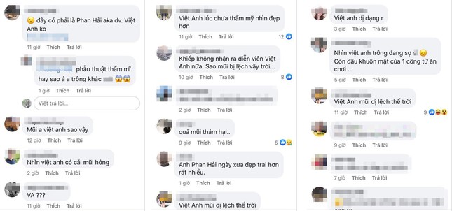 Dân mạng lại 'mắt tròn mắt dẹt' vì mũi dài khác lạ của Việt Anh ảnh 2