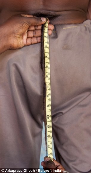 Người đàn ông có 'đuôi' dài 36 cm, leo trèo như khỉ ảnh 2