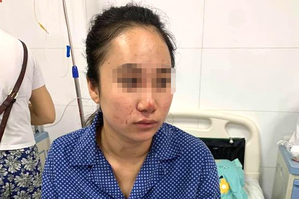 Vụ cô gái bị đánh dã man ở Hà Nội: Nghi do dàn dựng vụ đánh ghen? ảnh 1