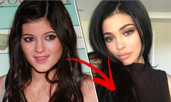 ‘Hot girl môi tều’ nhà Kardashian vẫn quyến rũ dù bỏ filler bơm môi ảnh 2