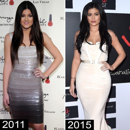‘Hot girl môi tều’ nhà Kardashian vẫn quyến rũ dù bỏ filler bơm môi ảnh 3