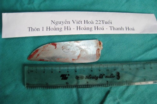 Cứu sống thanh niên bị đâm thủng phổi, đứt tủy sống ảnh 1