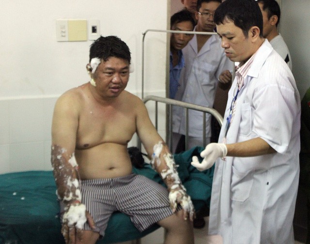 Ném “bom” xăng vào 1 người gây bỏng nặng ảnh 1
