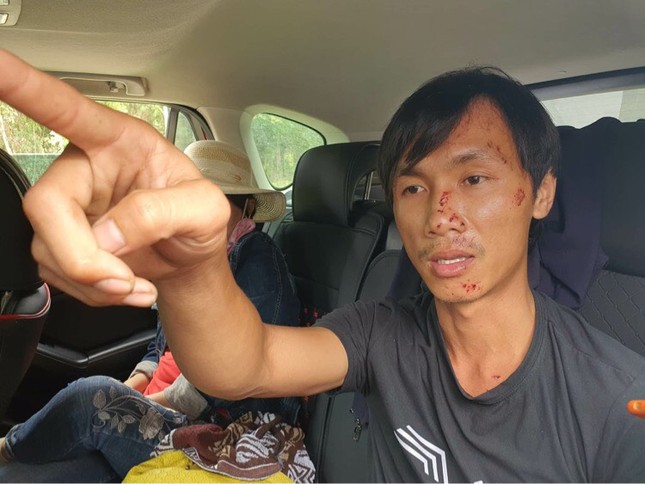 Vụ tai nạn thảm khốc ở Bình Thuận: Tài xế xe tải được đưa ra Nha Trang chụp chân ảnh 1