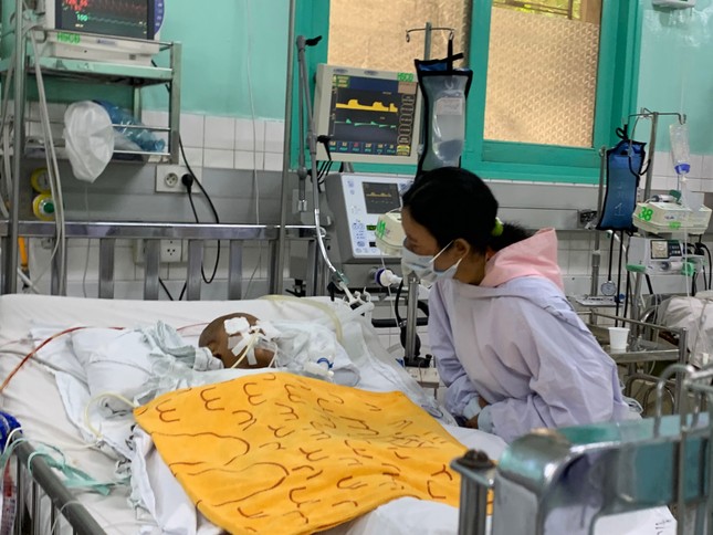 Bé trai 4 tuổi bị dượng đâm kéo xuyên mắt: Bác sĩ cố gắng giữ lại nhãn cầu ảnh 1