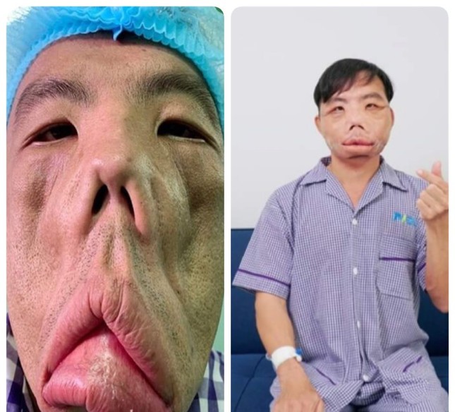 Ngắm gương mặt mới của chàng trai 'mặt quỷ' ảnh 1