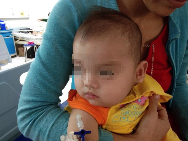 Bé trai có khối bướu to như quả bưởi trên mặt ảnh 3