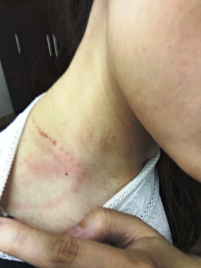 Thanh tra giao thông hành hung nữ nhân viên sở hữu xe quá tải 400%? ảnh 2