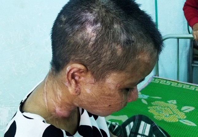 Kẻ tra tấn dã man nữ giúp việc như thời trung cổ lĩnh 10 năm tù ảnh 1