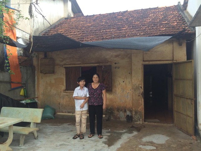 Cậu bé “Trư Bát Giới” và gần chục lần lên bàn mổ ảnh 4