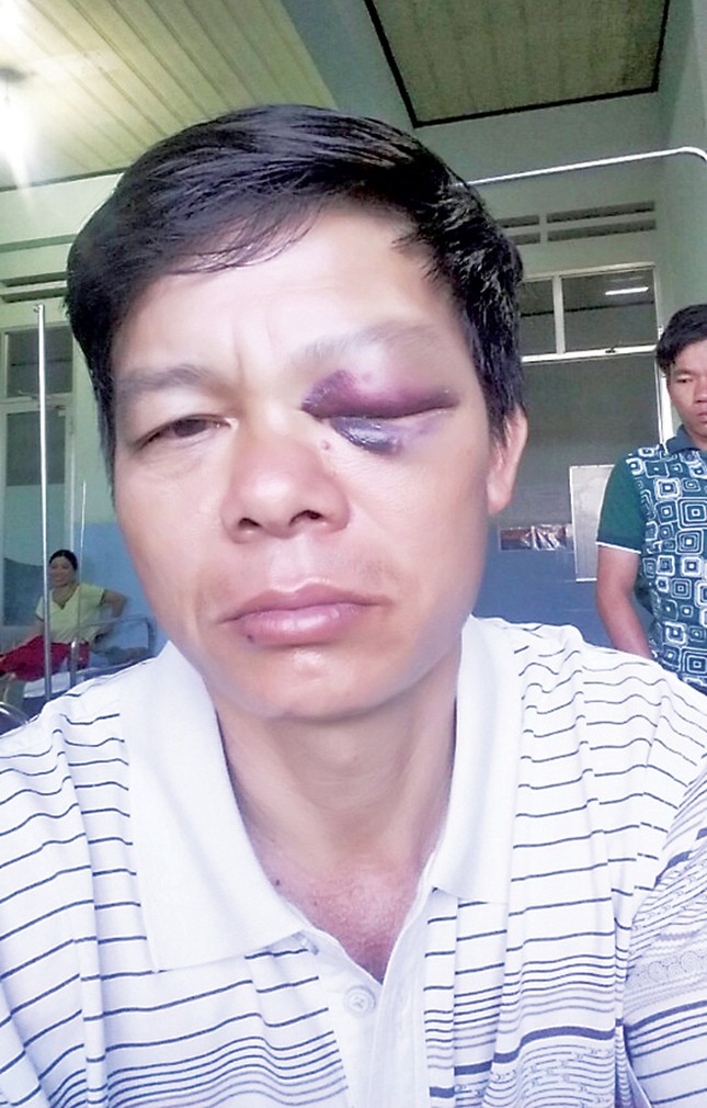 Ba kiểm lâm bị giật súng, hành hung tàn bạo ảnh 1