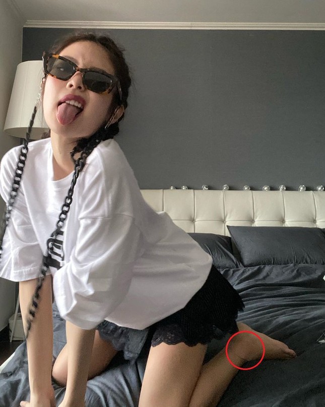 Showbiz 4/5: Người mẫu unisex của Việt Nam qua đời vì bị viêm tụy cấp ảnh 5
