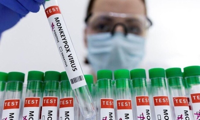 Có nên tiêm vắc xin ngừa đậu mùa khỉ? ảnh 1