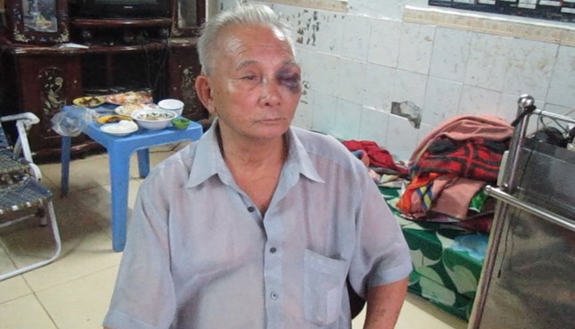 Ba người dân bị côn đồ đâm chém loạn xạ ảnh 2