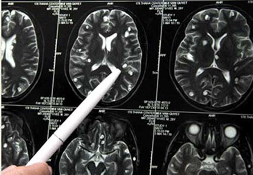 Sự thật nguy hiểm khi ăn thịt chó ảnh 1