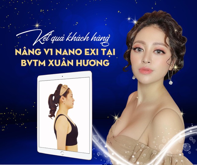 Giảm 50% nâng ngực nội soi NANO EXI tại Bệnh viện thẩm mỹ Xuân Hương ảnh 5