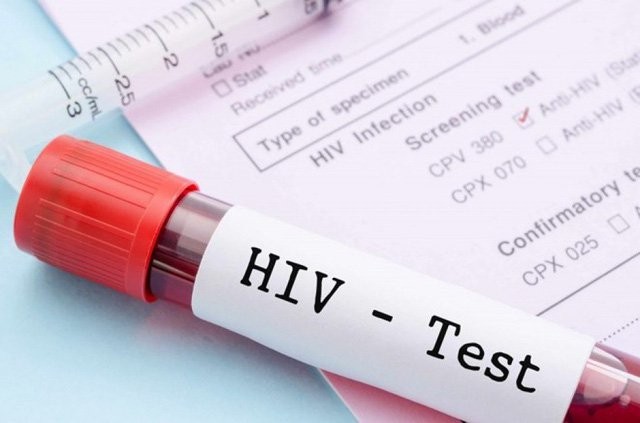 Khi có kết quả xét nghiệm HIV dương tính, người bệnh được thông báo thế nào? ảnh 1