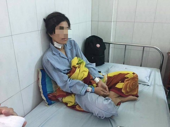 Khởi tố, bắt tạm giam người đàn ông bạo hành, cắt tai vợ cũ ảnh 1