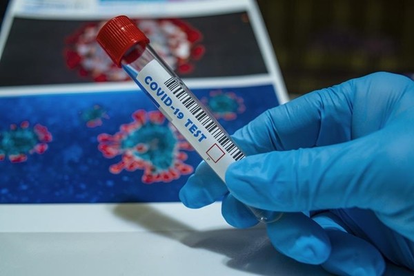 Người Úc nhận 5 triệu đồng nếu chịu đi xét nghiệm COVID-19, thêm 25 triệu nếu dương tính ảnh 2