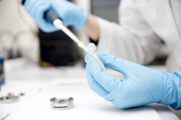 Bệnh nhân đầu tiên trên thế giới nhiễm COVID-19 hai lần, với hai chủng virus khác nhau ảnh 2