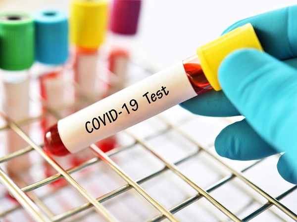 Phòng thí nghiệm thu tiền tỷ bằng cách bỏ qua xét nghiệm, cấp khống giấy âm tính COVID-19 ảnh 1